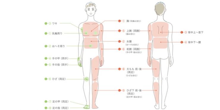 周南市の脱毛　男性脱毛(メンズ体脱毛)