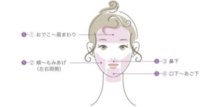 山口県周南市の脱毛 女性 FACIAL（お顔） 脱毛